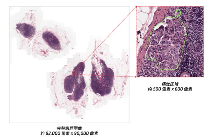 腾讯AI Lab“绝悟”首次将强化学习引入病理全片扫描，阅片效率提升400%