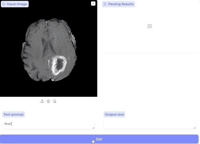 AI一键解析九大生物医学成像模式，用户只需文字prompt交互，微软UW等新研究登Nature Methods