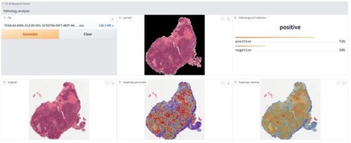 组织病理学图像可以通过EXAONEPath进行分析和可视化，识别细胞内可能的基因变异。颜色变化可以提供关于细胞中潜在基因变异或异常的重要线索。图片来源：LG AI Research