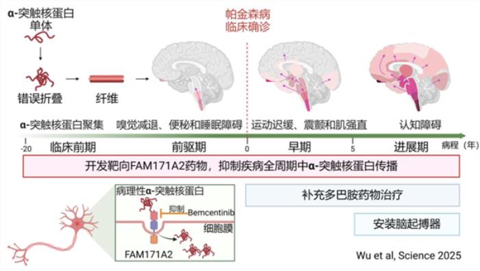 全球首次！复旦团队发现帕金森全新治疗靶点：AI大显身手